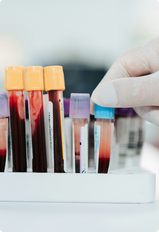 The Importance of Point-of-Care Testing